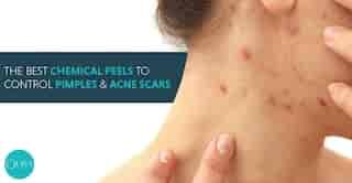 oliva-skin-and-hair-clinic-alwarpet-chennai-dermatologists-1tkitz6i5i